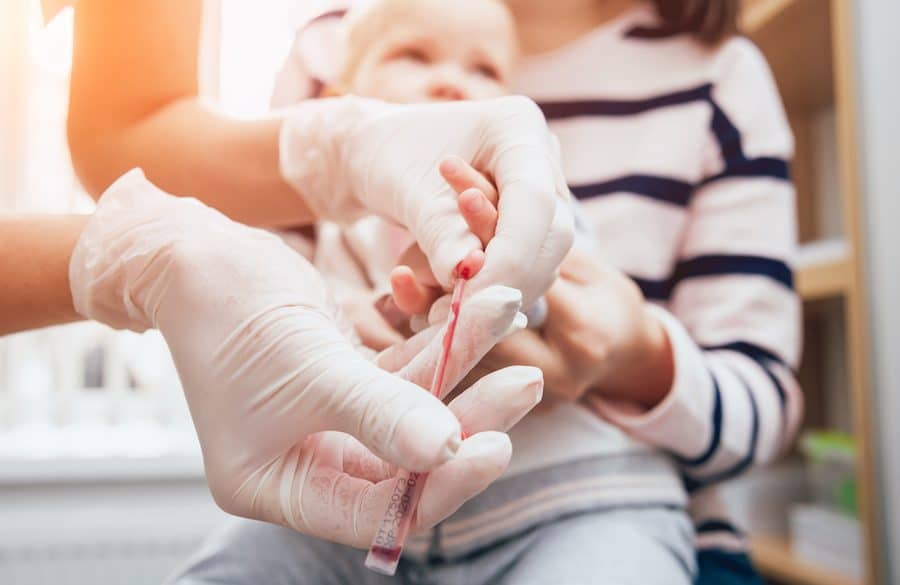 Nurse taking a little child blood sample. Medical equipment. Blood test