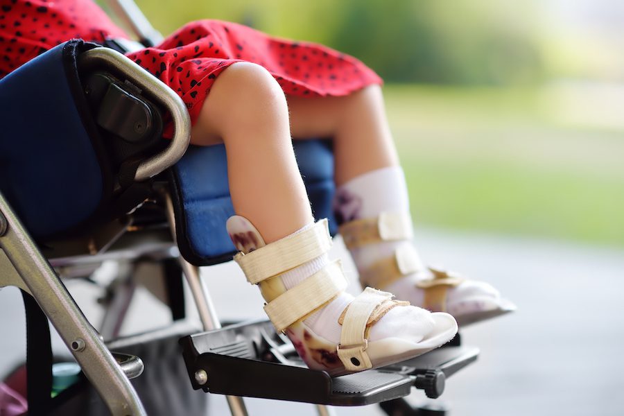 Disabled girl sitting in wheelchair. On her legs orthosis. Child cerebral palsy. Inclusion. Family with disabled kid.