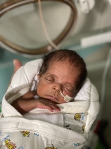 Milo as a newborn with a breathing tube in his nose